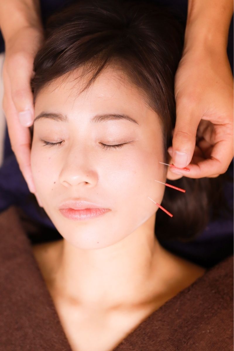 難病中医学中国鍼灸院 施術イメージ